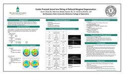 Essilor ProLook Sceral lens fitting of Pellucid Marginal Degeneration