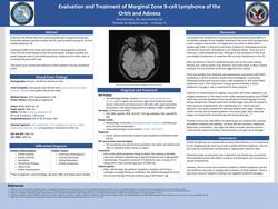 Evaluation and Treatment of Marginal Zone B-cell Lymphoma of the Orbit and Adnexa