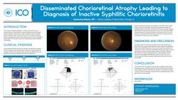 Disseminated Chorioretinal Atrophy Leading to Diagnosis of Inactive Syphilitic Chorioretinitis