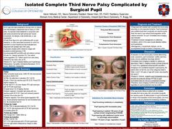 Isolated Complete Third Nerve Palsy Complicated by Surgical Pupil