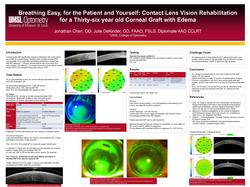 Breathing Easy, for the Patient and Yourself: Contact Lens Vision Rehabilitation for a Thirty-six-year-old Corneal Graft with Edema