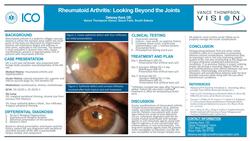 Rheumatoid Arthritis: Looking Beyond the Joints