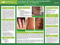 Case Report: Skin lesions and hypopigmentation associated with use of Restasis