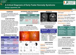 A Critical Diagnosis of Early Foster Kennedy Syndrome