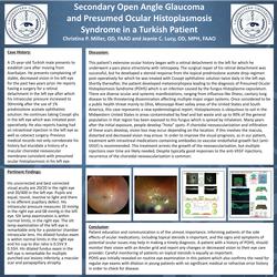 Secondary Open Angle Glaucoma in Presumed Ocular Histoplasmosis Syndrome in a Turkish Patient