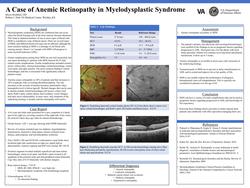 A Case of Anemic Retinopathy in Myelodysplastic Syndrome