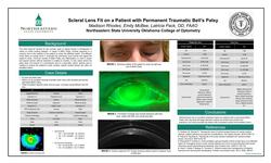 Scleral Lens Fit on a Patient with Permanent Traumatic Bell’s Palsy