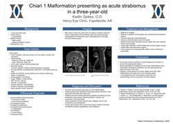 Chiari 1 Malformation presenting as acute strabismus in a three year old