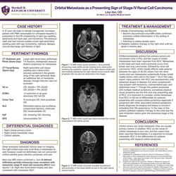 Orbital Metastasis as a Presenting Sign of Stage IV Renal Cell Carcinoma