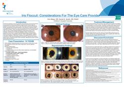 Iris Flocculi: Considerations For The Eye Care Provider