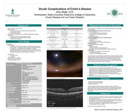 Ocular Complications of Chron’s Disease