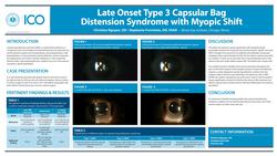 Late-onset Type 3 Capsular Bag Distension Syndrome with Myopic Shift