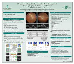 Presumed Idiopathic Intracranial Hypertension with Underlying Optic Nerve Head Drusen