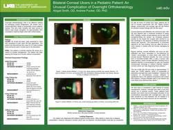 Bilateral Corneal Ulcers in a Pediatric Patient: An Unusual Complication of Overnight Orthokeratology