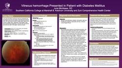 Vitreous Hemorrhage due to Type II Diabetic Retinopathy