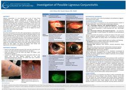 Investigation of Possible Ligneous Conjunctivitis