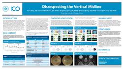 Disrespecting the Vertical Midline