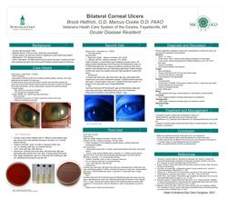 Bilateral Corneal Ulcers in Noncompliant Contact Lens wearer with a History of Incarceration.