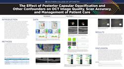 The Effect of Posterior Capsular Opacification and Other Confounders on OCT Image Quality, Scan Accuracy, and Management of Patient Care