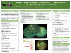 Bilateral Retinal Detachments, Glaucoma, and Macular Hole in a Patient with Stickler Syndrome