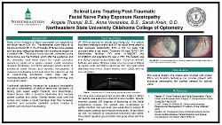 Scleral Lens Treating Post-Traumatic Facial Nerve Palsy Exposure Keratopathy