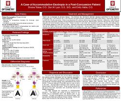 A Case of Accommodative Esotropia in a Post-Concussion Patient