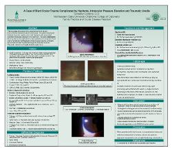 A Case of Blunt Ocular Trauma Complicated by Hyphema, Intraocular Pressure Elevation and Traumatic Uveitis