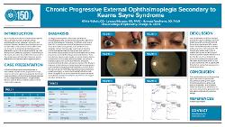 Chronic Progressive External Ophthalmoplegia Secondary to Kearns Sayre Syndrome