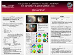 Management of Contact Lens Induced Limbal Stem Cell Deficiency with Scleral Contact Lenses