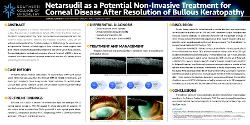 Netarsudil as potential non-invasive treatment for corneal disease after resolution of bullous keratopathy complications