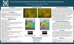 A Case of Recurrent Hemiretinal Vein Occlusion Secondary to Uncontrolled Hypertension