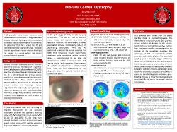 Management of Macular Corneal Dystrophy